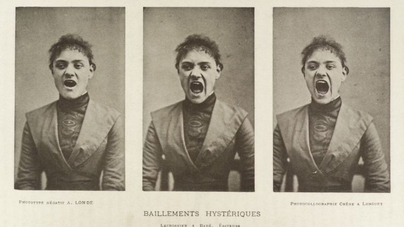 Hình ảnh một bệnh nhân mắc Hysteria