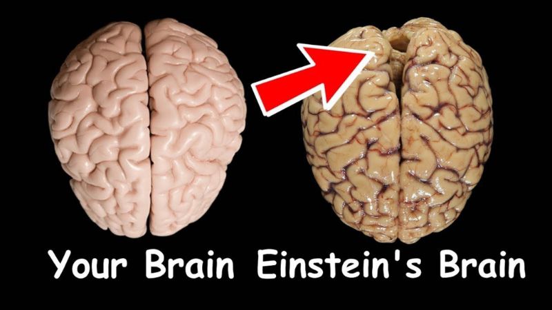 Sự khác biệt giữa bộ não người bình thường và Albert Einstein