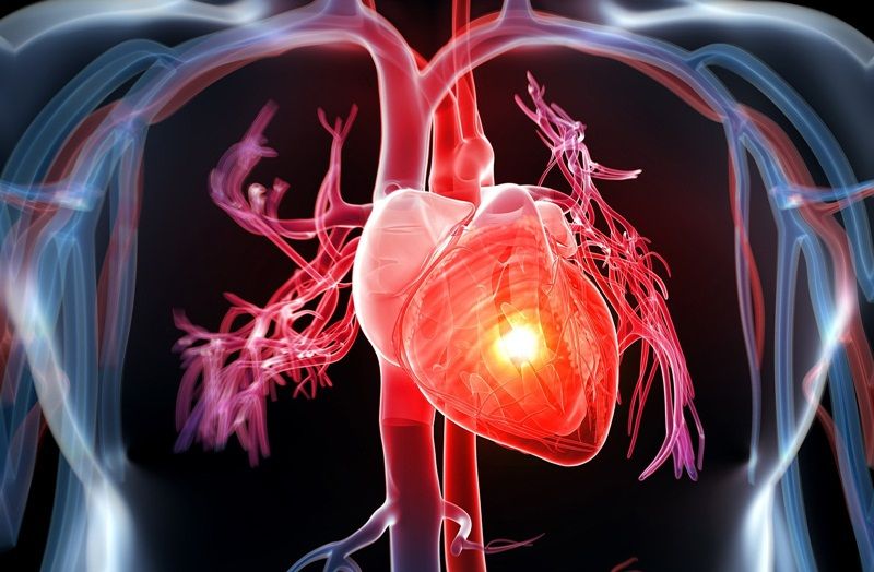 Hội chứng Wellen có thể xuất phát từ người có vấn đề về tim mạch 