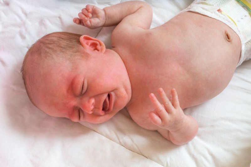 Hội chứng West thường khởi đầu ở giai đoạn trẻ từ 3 đến 8 tháng tuổi 
