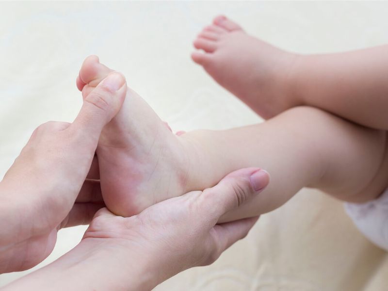 Có rất nhiều nguyên nhân dẫn đến tình trạng bé bị tật đi nhón chân 